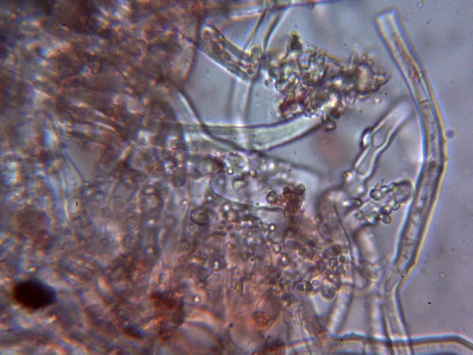 Microscopía de Phanerochaete velutina - 12 - Hifas con cristalizaciones 2